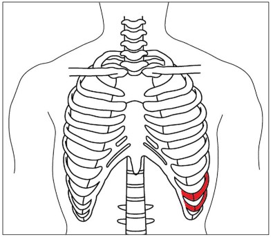 B738-ENE-of-Miyazaki-2023-broken-ribs